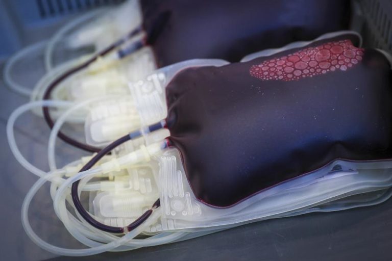 Adiadas quatro cirurgias no Santa Maria por falta de “unidades específicas de sangue”